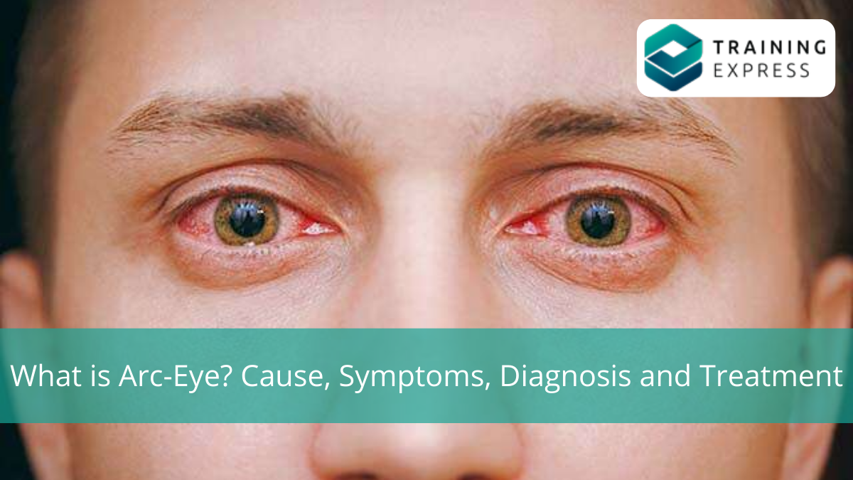 What is Arc-Eye? Cause, Symptoms, Diagnosis and Treatment – Training Express
